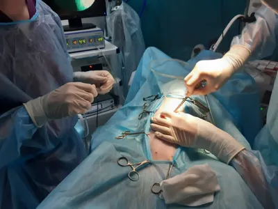 Стоматологическая хирургия | клиника «Мастер ЗТЛ» Уфа