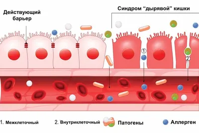 Раздраженный кишечник. Симптомы и лечение - клиника ServiDigest - Варселона