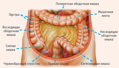 Рак тонкого кишечника: симптомы, признаки, диагностика, лечение