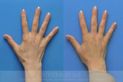 Фото кистей рук для использования в рекламе