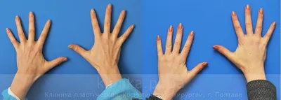 Фотографии кистей рук с разными позами