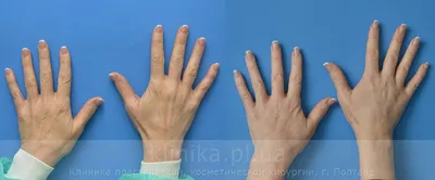 Кисти рук в высоком разрешении для скачивания в JPG формате