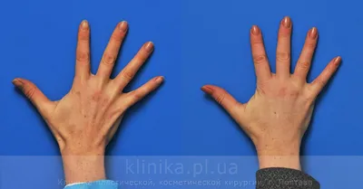 Изображения кистей рук в прозрачном формате
