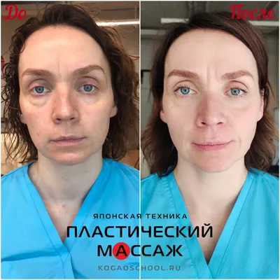 Классический массаж лица | Лицо, Массаж, Ботокс губы