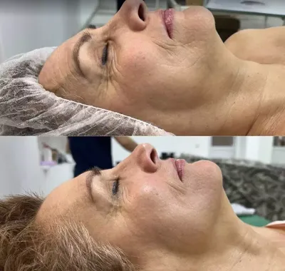 Массаж лица (ручной массаж) - Platonova Clinic