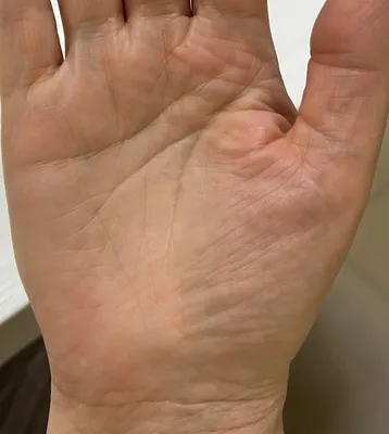 Кольцо на руке: фото для создания уникального оформления