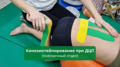 Комплекс упражнений ЛФК для опорно-двигательного аппарата