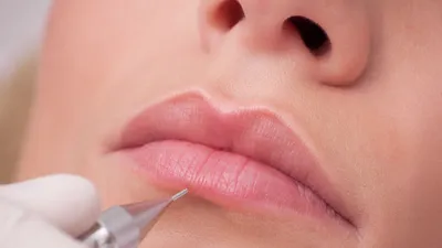 Контур губ татуаж: фото с нанесенной блеском