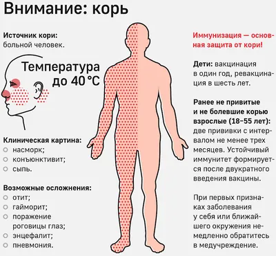 С заболевшей корью девушкой в петербургском ЖК контактировали 3 тысячи  человек - Газета.Ru | Новости