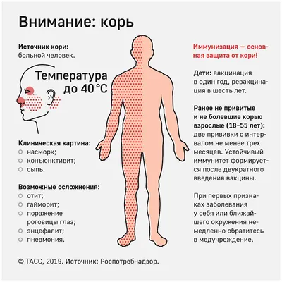 Профилактика кори - Национальный центр Медицины РС(Я), Республиканская  больница №1