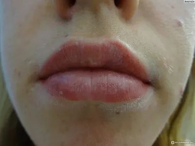 Корочки после татуажа губ: фотография с легким эффектом размытия