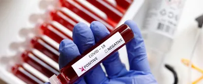 В Австралии нашли подавляющее коронавирус лекарство