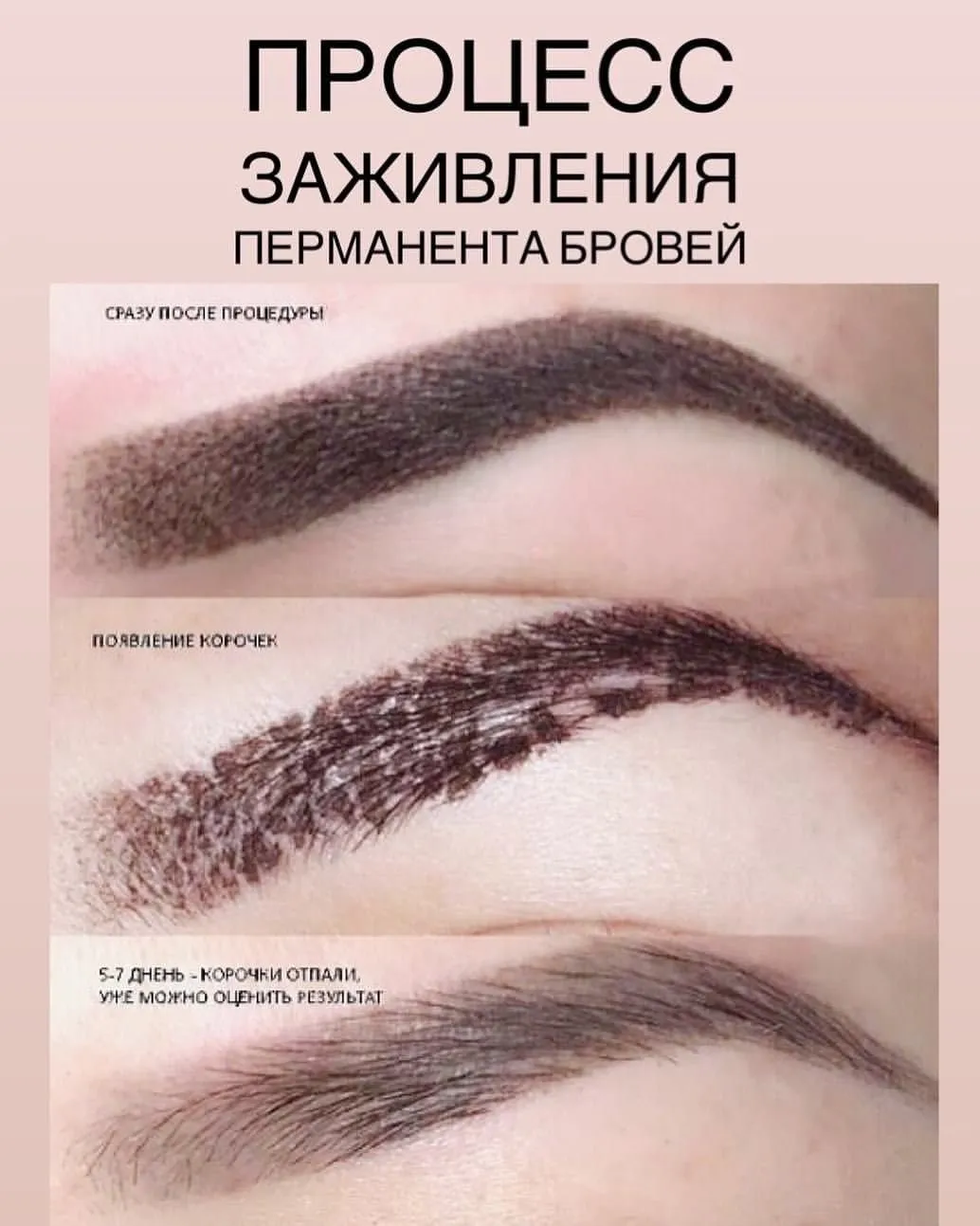 Как подобрать форму бровей при коррекции после татуажа: фотошаги Как подобрать форму бровей при коррекции после татуажа: фотошаги