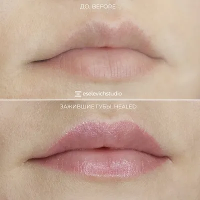 Фотографии коррекции татуажа губ: перед и после