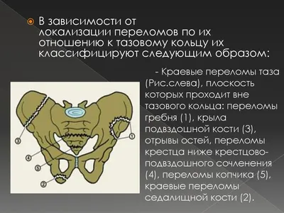 Кости грудной клетки. Кости таза - постер (ID#1601939541), цена: 31 ₴,  купить на Prom.ua