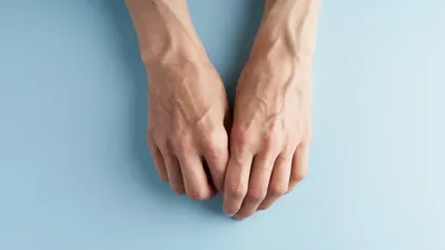Руки с проблемной кожей: фотография в высоком разрешении