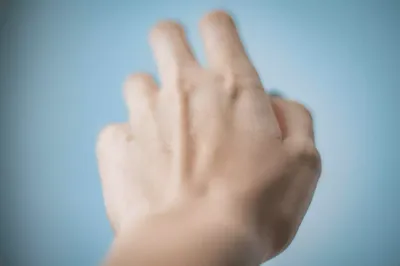 Фотография рук с проблемной кожей: PNG формат