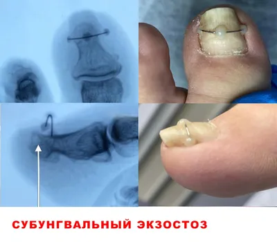Кожные заболевания на пальцах рук 14 фото