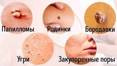Изображение кожных заболеваний на пальцах рук: PNG формат