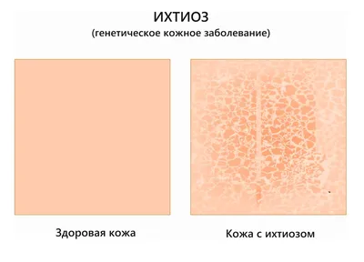 Варикозный (венозный) дерматит на ногах - лечение | Медицинский центр  ФлебоПлюс