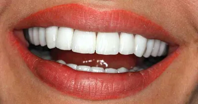 Как поднять уголки губ и красиво улыбаться? | Стиль | WB Guru