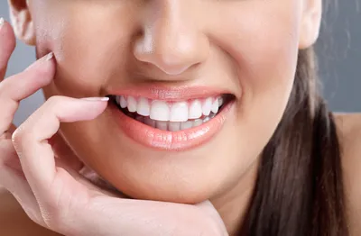 Эстетическая стоматология. 10 признаков идеальной улыбки. | Эстетическая  стоматология в Санкт-Петербурге Кирилла Костина