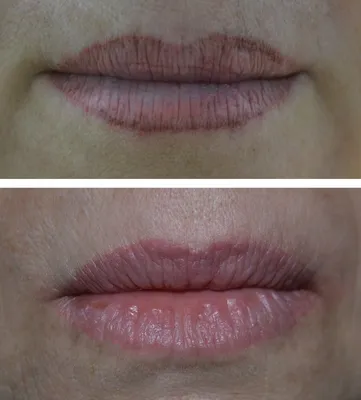 Трансформация губ: фотографии татуажа до и после