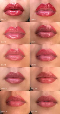До и после: фотографии татуажа губ