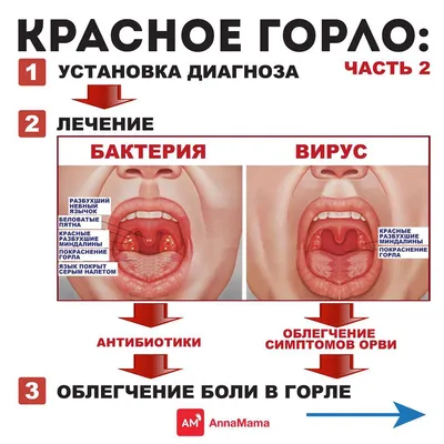 Продолжаю про красное горло. ☝🏻Вчера (#аннамама_горло ) я написала, что  антисептики, спреи и растворы для горла не действуют на вирусы… | Health