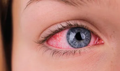 Чем объясняется эффект красных глаз на фотографиях? — Музей фактов
