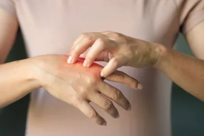Изображение рук с красными пятнами: какие методы лечения безопасны во время беременности?