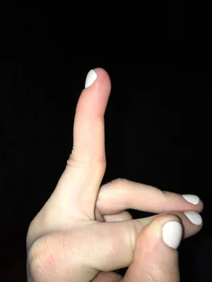 Изображение рук с кривыми пальцами