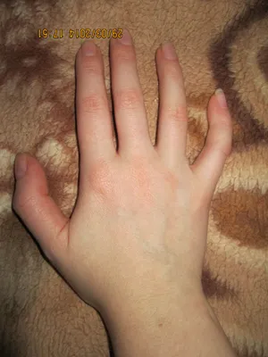 Изображение рук с кривыми пальцами в художественном стиле