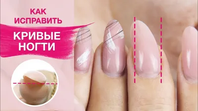 Кривые пальцы на руках: уникальное изображение