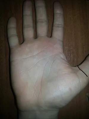 Фотография рук с кривыми пальцами: изображение с натуральным освещением