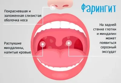 Доступность для каждого: почему инклюзивный дизайн нужен всем | Читать  design mate