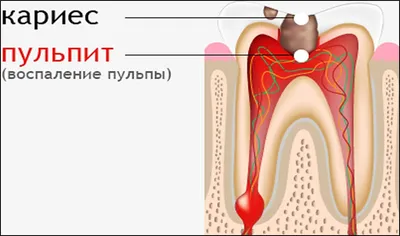 Лечение рубцов и постакне, удаление рубцов и шрамов в Одессе