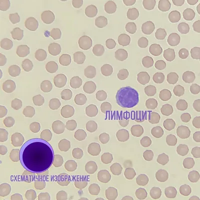 Лейкоциты — стоковые фотографии и другие картинки Basophil - Basophil,  Eosinophil, Monocyte - iStock