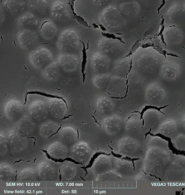 Лейкоциты в мазке крови стоковое фото. изображение насчитывающей красно -  121422500