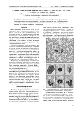 Клетки крови: лейкоциты, эритроциты, тромбоциты — Мария Семочкина на  TenChat.ru