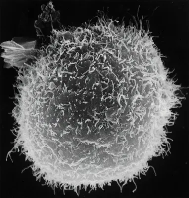 Лейкоциты в электронном микроскопе | Пикабу