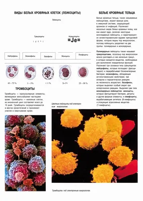 Анормалные лейкоциты стоковое изображение. изображение насчитывающей клетки  - 97102099