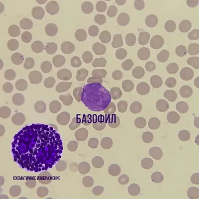 Лейкоциты на фоне клеток крови Стоковое Фото - изображение насчитывающей  медицинско, людск: 170267768