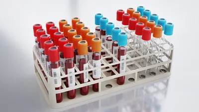 Общий анализ крови у животных. Лейкоциты и их виды часть 2