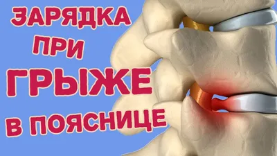 ЛФК при переломе позвоночника | Реабилитационный центр ЭйрМед в СПб
