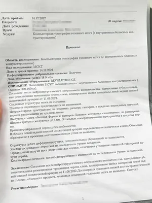 Инсульт в 32 года: отзыв о лечении, реабилитация, расходы на восстановление