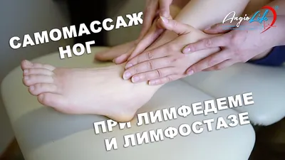 Комплексная Противоотечная Терапия Лимфостаза