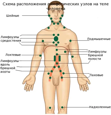 Лимфедема (лимфостаз): симптомы, причины, диагностика, чем опасна, цены на  лечение лимфедемы