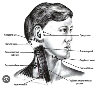 Причины увеличения лимфоузлов. | Дарья Кобец. Врач-онколог химиотерапевт |  Дзен
