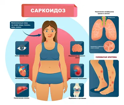 Проекции внутренних органов на стопе | Лимфатическая система, Массаж,  Альтернативное лечение